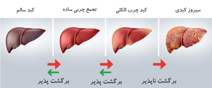 مصرف تخم مرغ و کبد چرب 